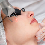 Erbium YAG Laser Vs. CO2 Laser: Which Is Better?
